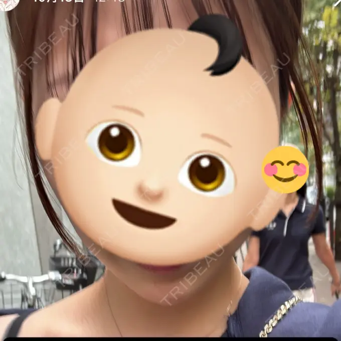 ヒアルロン酸溶解 EOL CLINIC【オルクリニック】 BEFORE メイン用