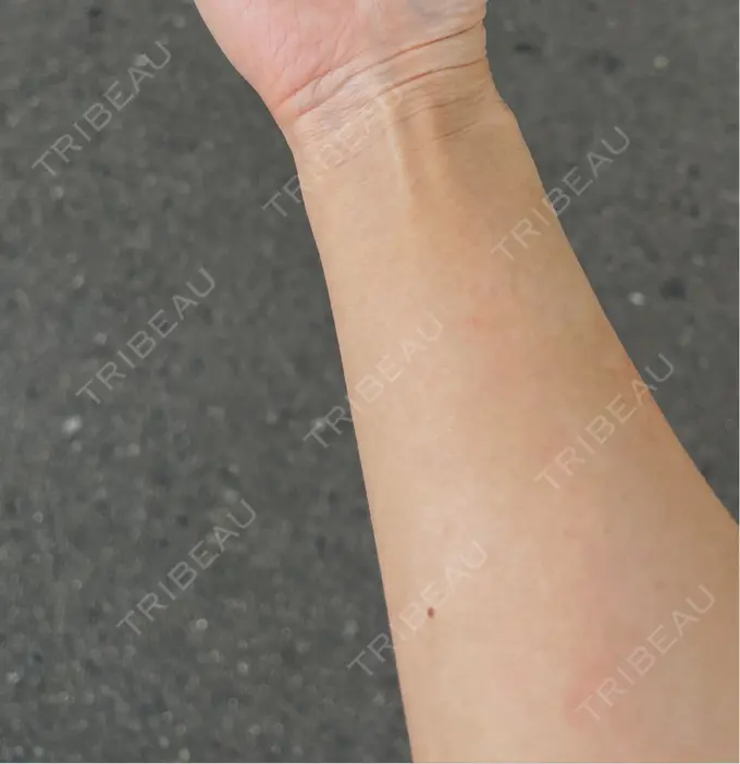 白玉点滴・注射 城本クリニック 名古屋院 BEFORE メイン用