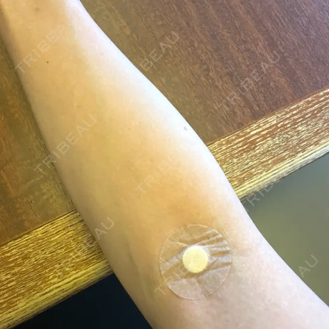 その他（肌） 城本クリニック 新宿院 BEFORE メイン用