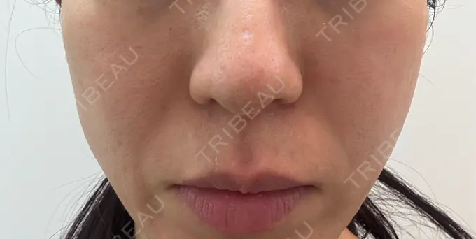 ジャルプロ 城本クリニック 静岡院 BEFORE メイン用