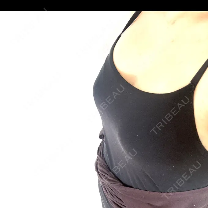 脂肪吸引（脚） / 豊胸（脂肪注入） 湘南美容クリニック Regno 銀座院 BEFORE メイン用