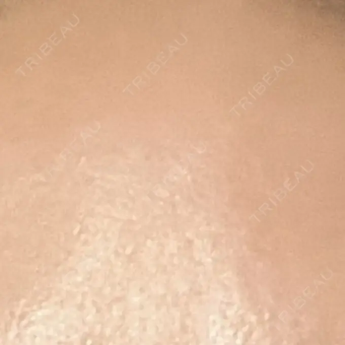 プラセンタ注射 新宿駅三丁目クリニック BEFORE メイン用