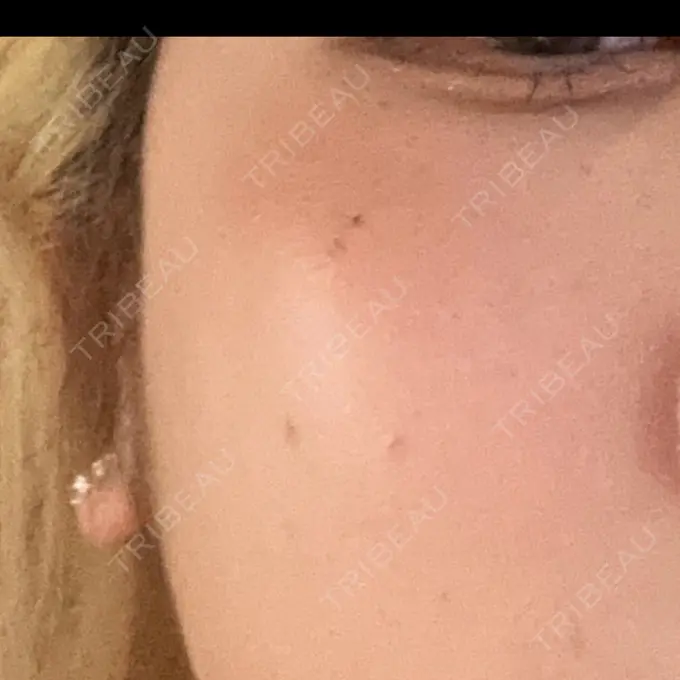 ルメッカ ルラ美容クリニック 名古屋栄院 / ルラスキンクリニック 名古屋栄院 BEFORE メイン用