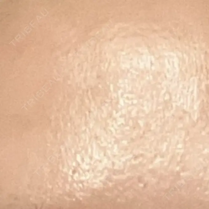 プラセンタ注射 吉祥寺アイビークリニック BEFORE メイン用