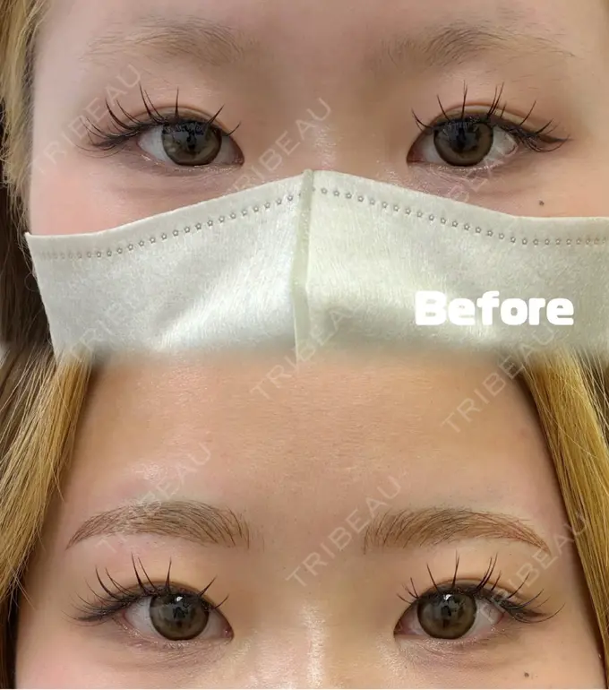 アートメイク（眉） グランジョイクリニック BEFORE メイン用