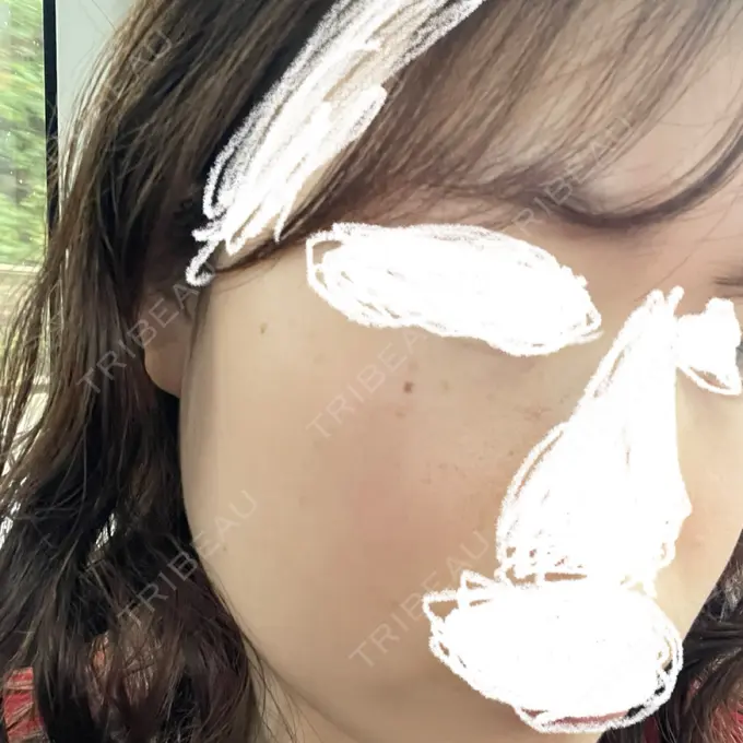 ルメッカ Otus Clinic 【オータスクリニック】 BEFORE メイン用