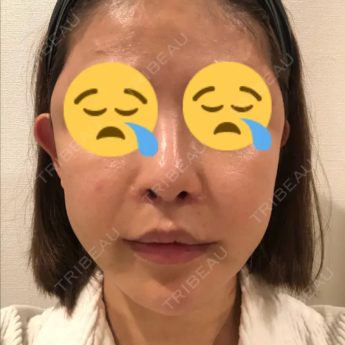 あごプロテーゼ / 前額リフト / 切開リフト THE PLAN（ザ・プラン）美容整形外科・皮膚科 BEFORE メイン用