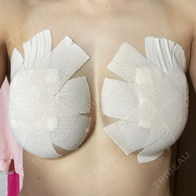 豊胸（シリコンバッグ） / 胸修正 / その他（胸） 三輪皮フ科形成外科 BEFORE メイン用