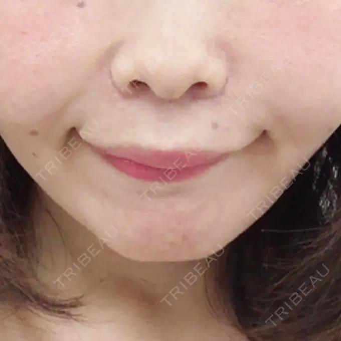 人中短縮 湘南メディカル記念病院（両国） BEFORE メイン用