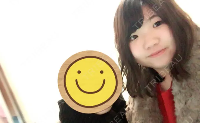 二重埋没 湘南美容クリニック 京都院 BEFORE メイン用