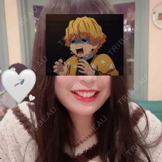 脂肪吸引（顔） ガーデンクリニック 名古屋院 BEFORE メイン用