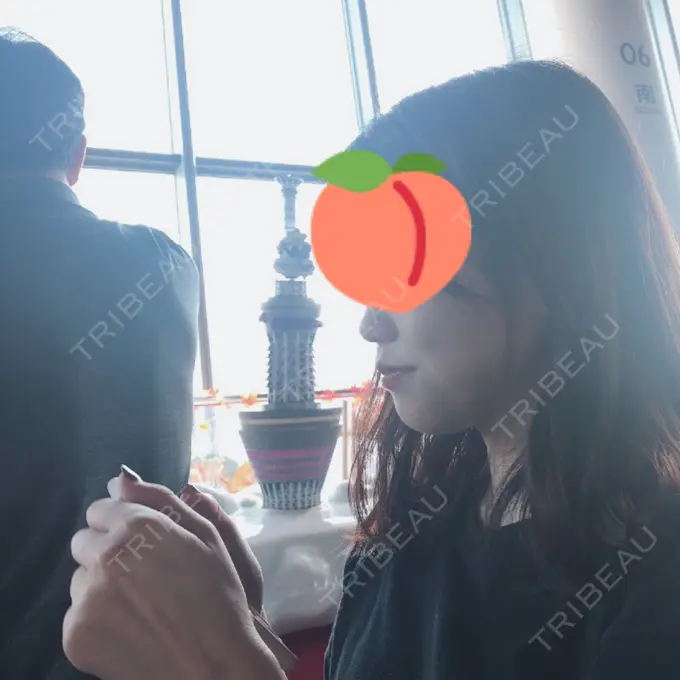 鼻尖形成（切開） みずほクリニック BEFORE メイン用