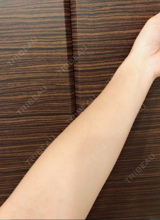 美容点滴・美容注射（美肌） 東京美容外科 梅田院 BEFORE メイン用