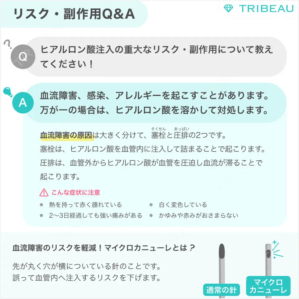 ヒアルロン酸注入（唇）の解説画像4