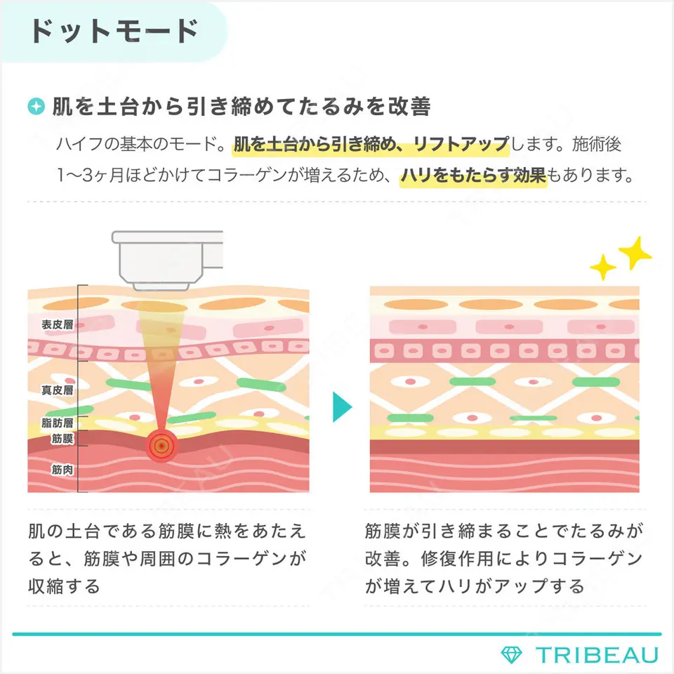 ハイフ（首）の解説画像2