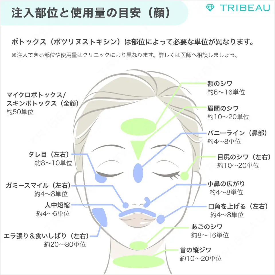 ボトックス（ガミースマイル）の解説画像1