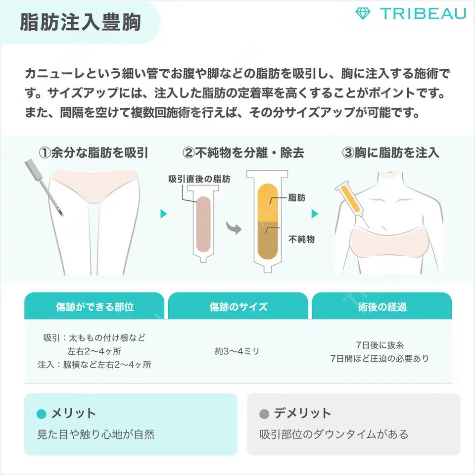 豊胸（シリコン＋脂肪併用）の解説画像2