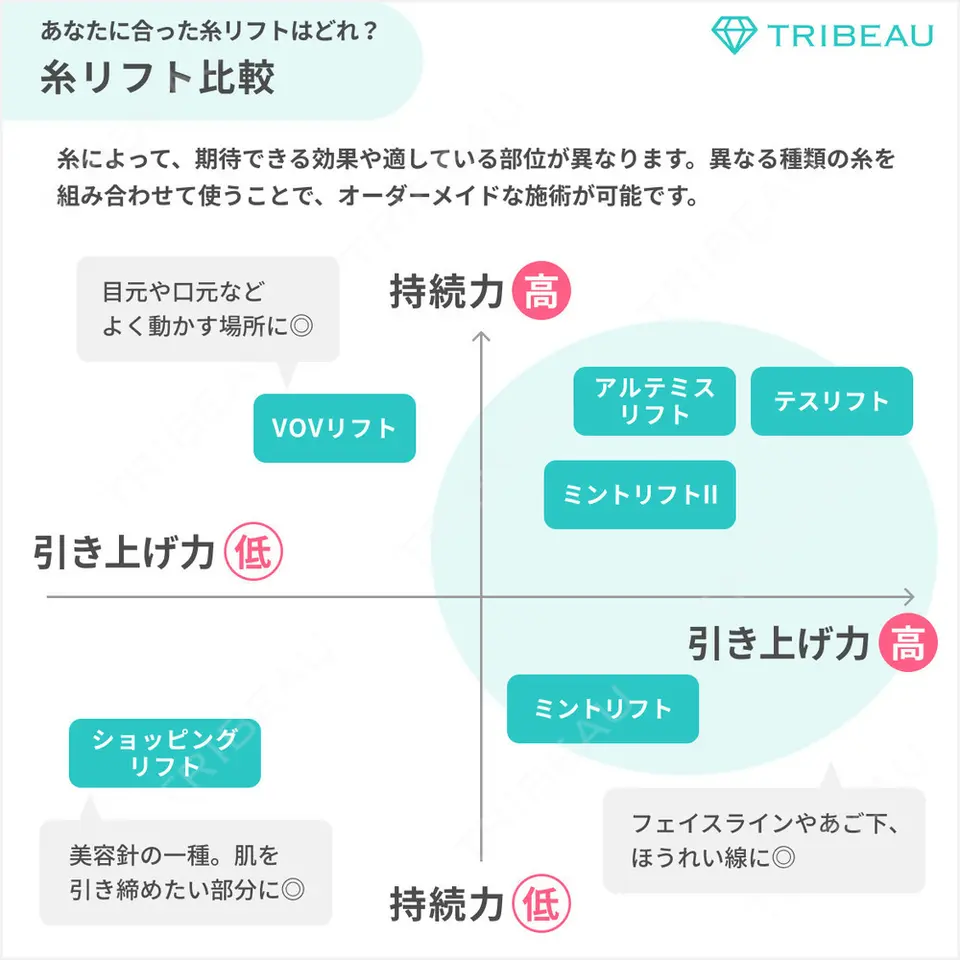 糸リフトの解説画像3