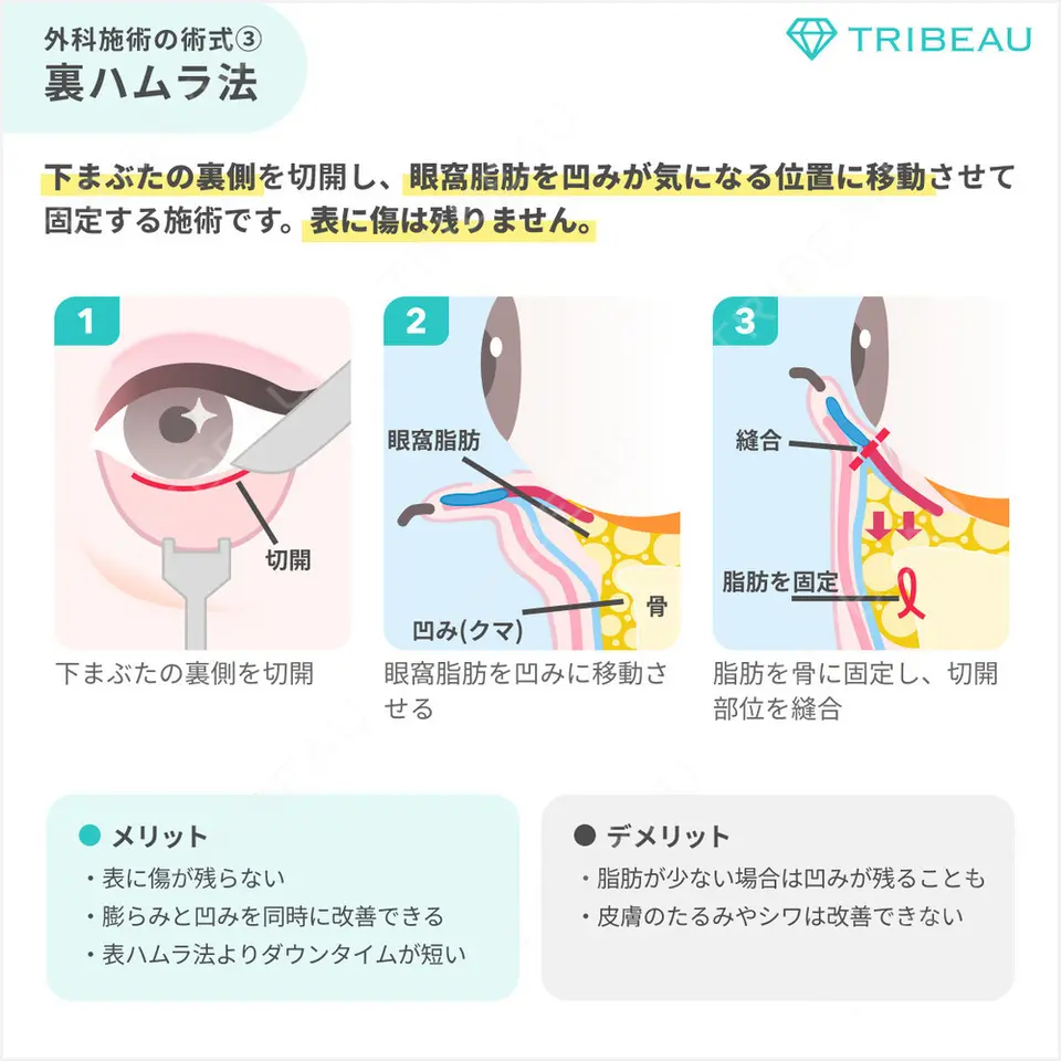 クマ治療の解説画像6