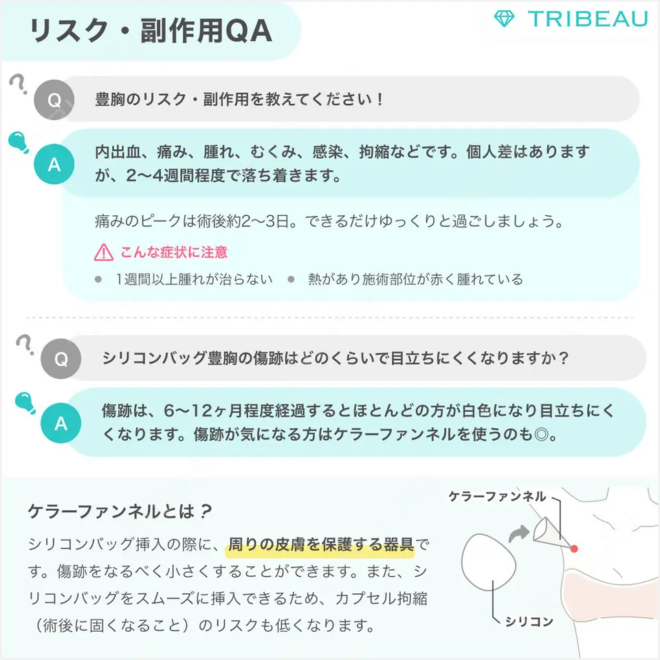 豊胸（シリコン＋脂肪併用）の解説画像7