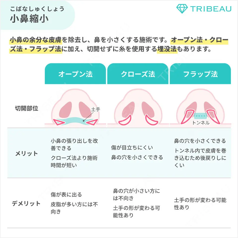 小鼻縮小（切開）の解説画像4