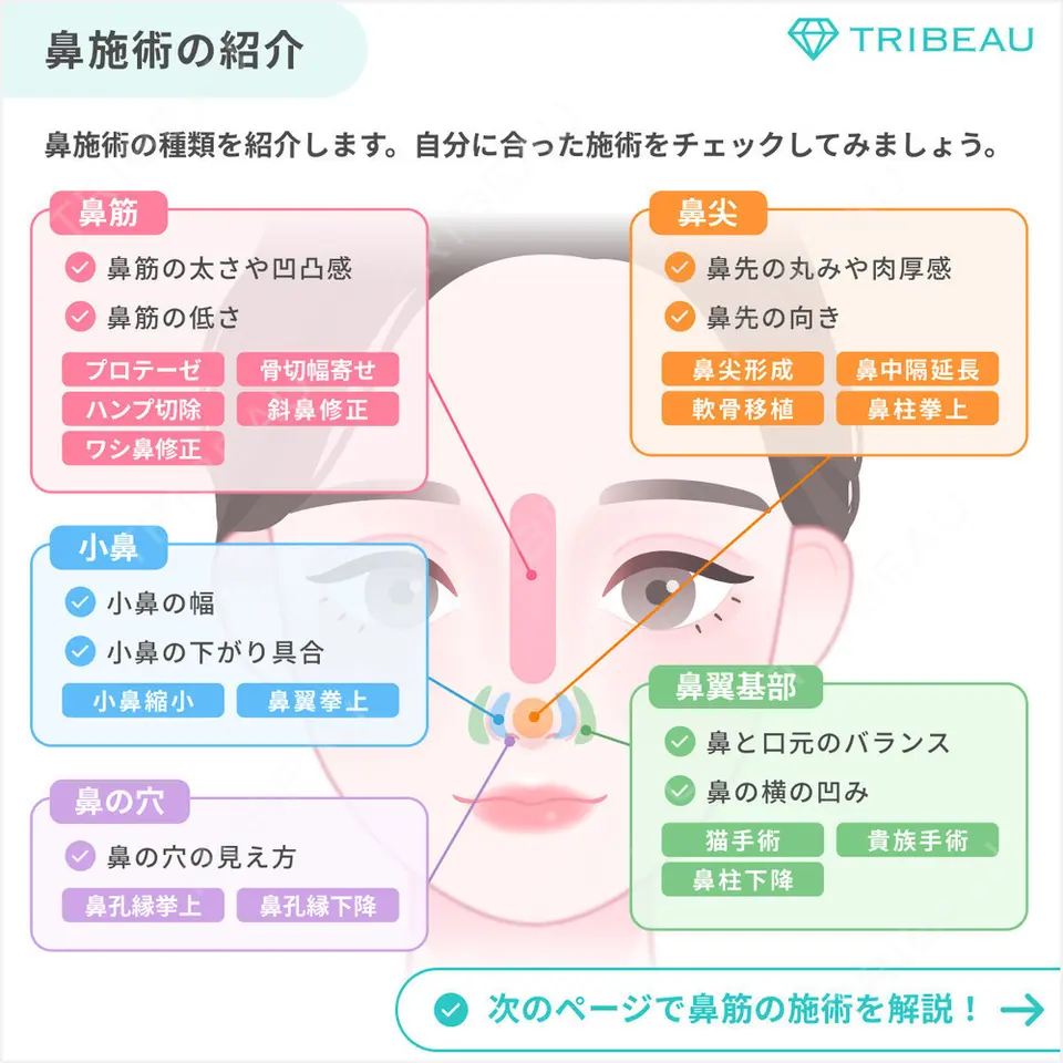 ワシ鼻修正・ハンプ切除の解説画像2
