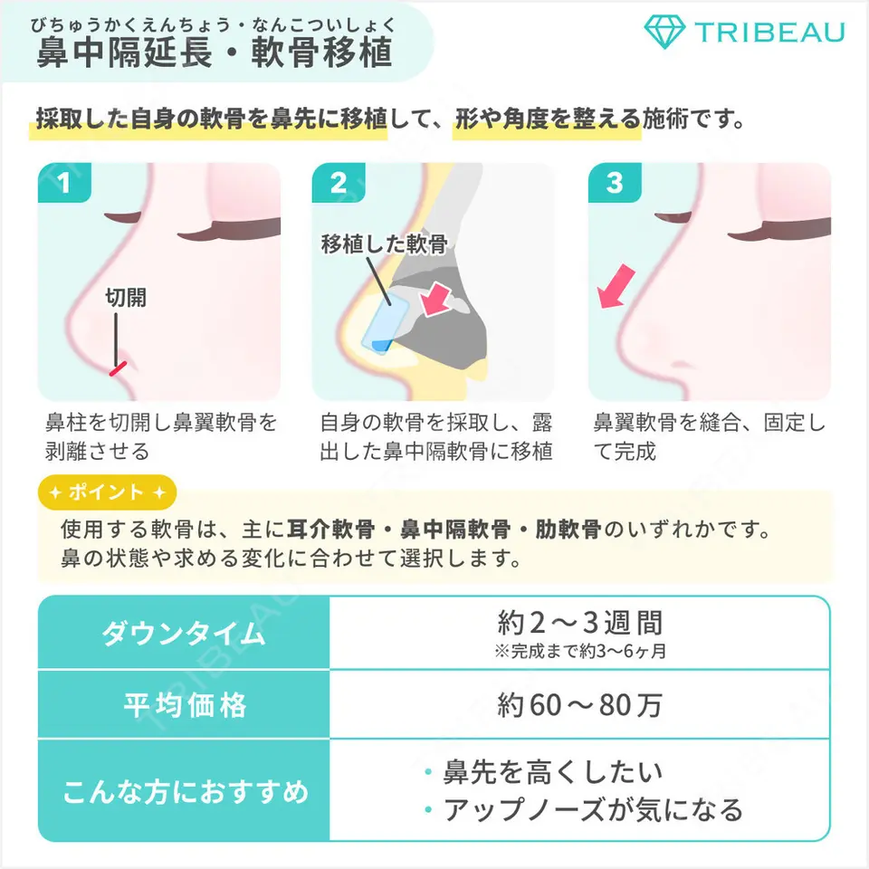 鼻尖縮小の解説画像4