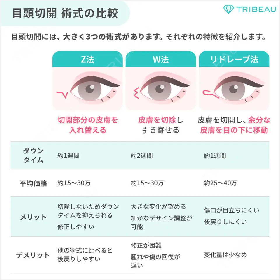 蒙古ひだ形成の解説画像3