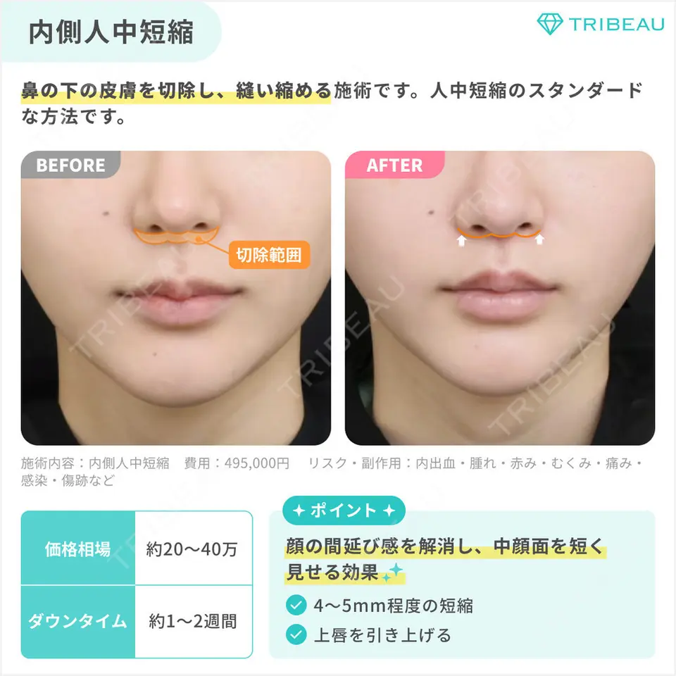 人中短縮の解説画像2