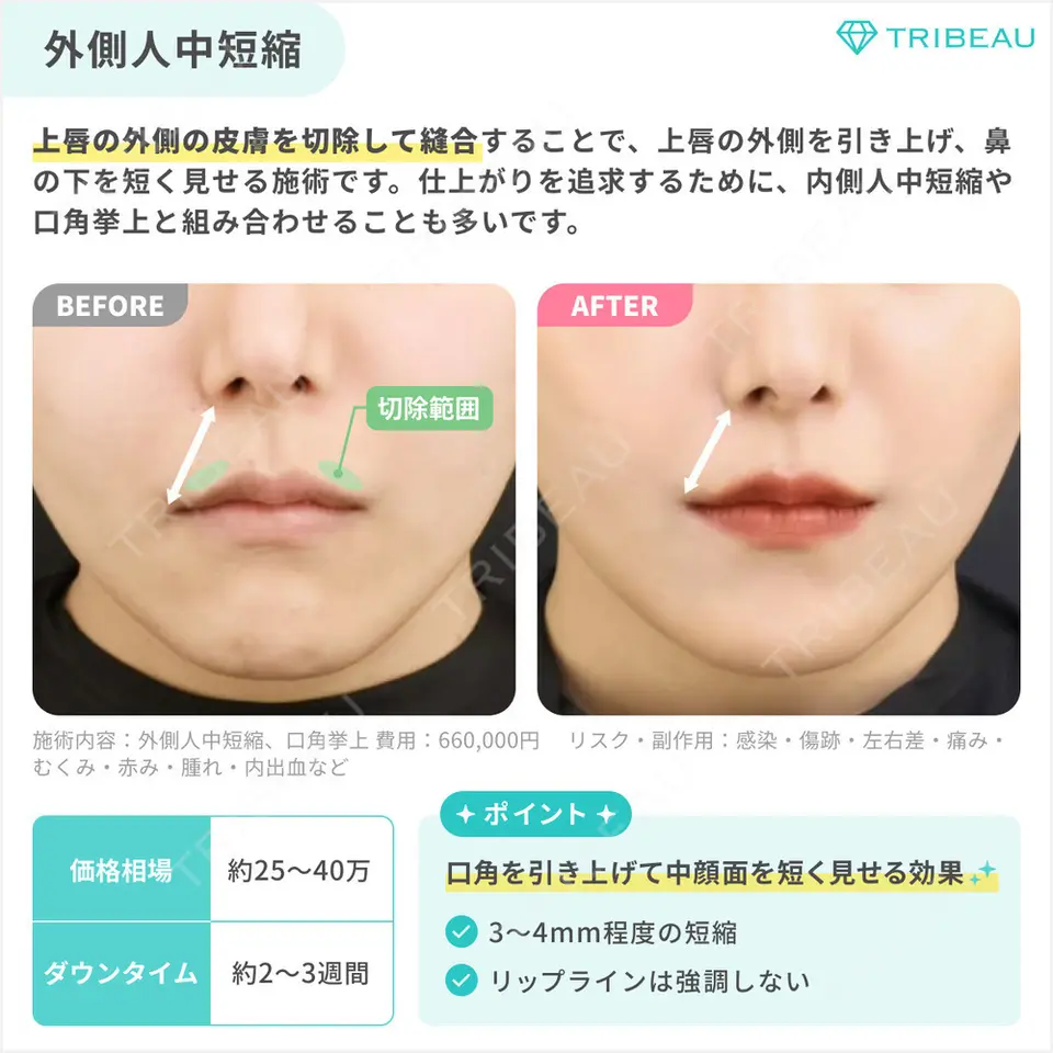 人中短縮の解説画像4