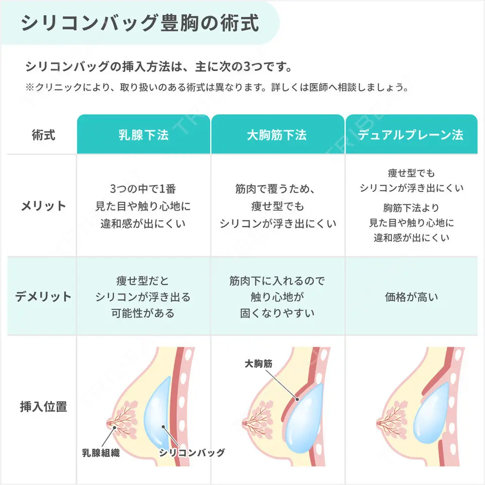 豊胸（脂肪注入）の解説画像6