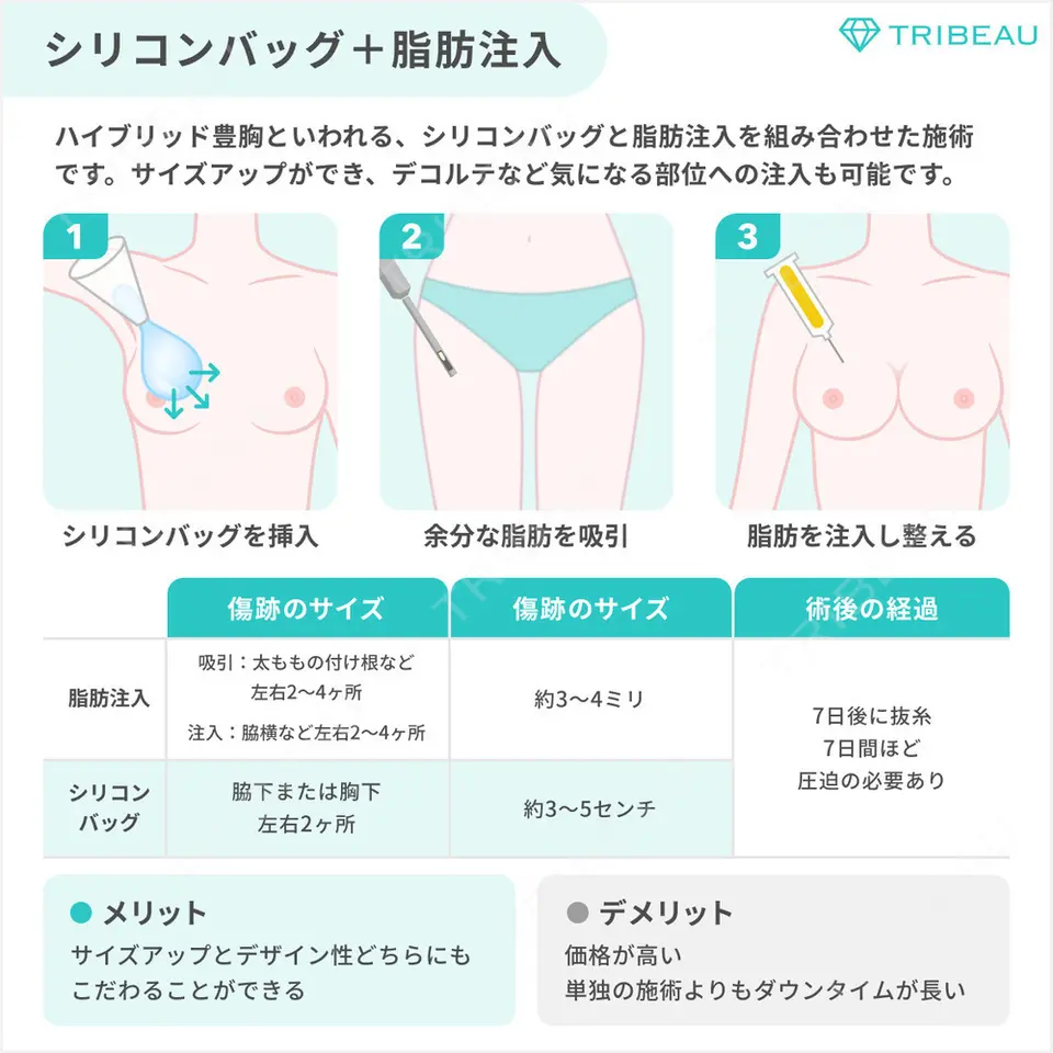 豊胸（脂肪注入）の解説画像7