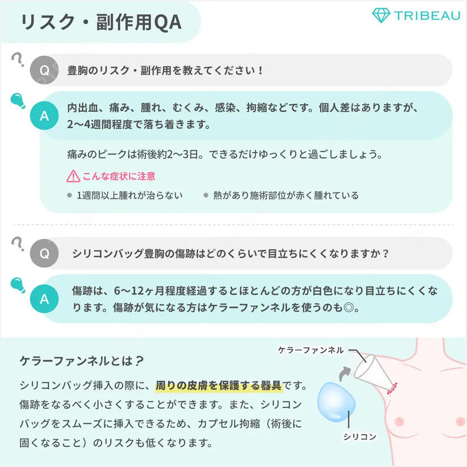 豊胸（脂肪注入）の解説画像8