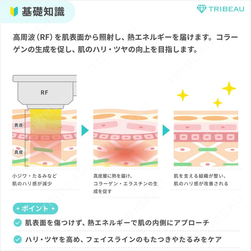 RF（高周波）たるみ治療の解説画像1