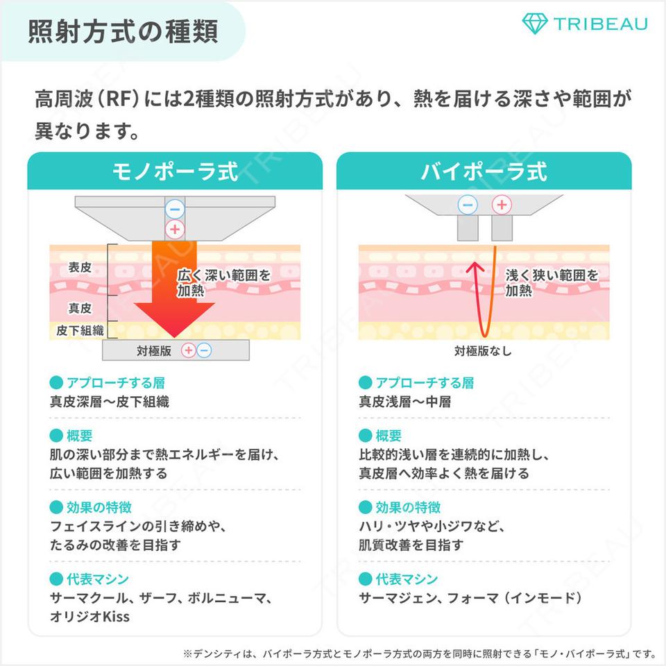 RF（高周波）たるみ治療の解説画像2