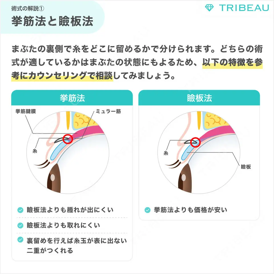 二重埋没の解説画像3