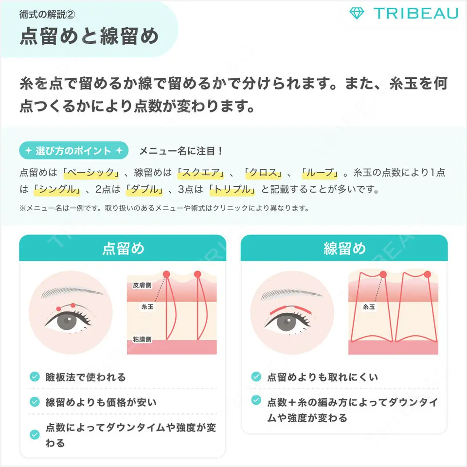 二重埋没の解説画像4