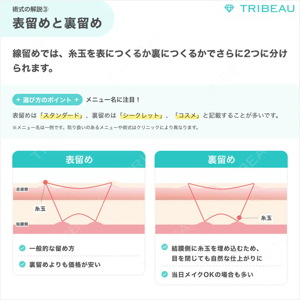 二重埋没の解説画像5