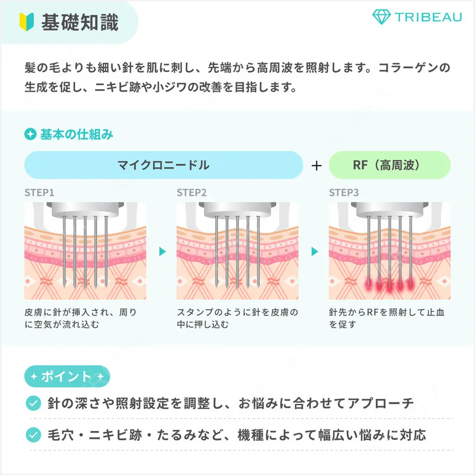ポテンツァの解説画像1