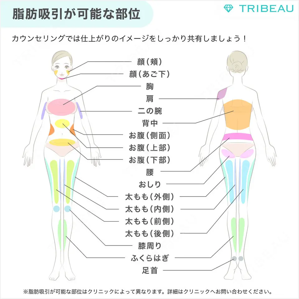 脂肪吸引（二の腕）の解説画像2