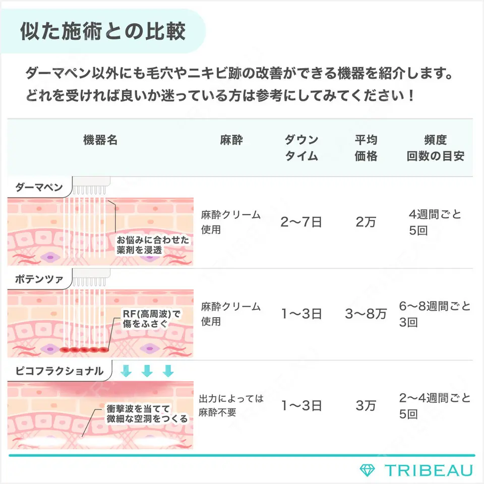 ダーマペンの解説画像4