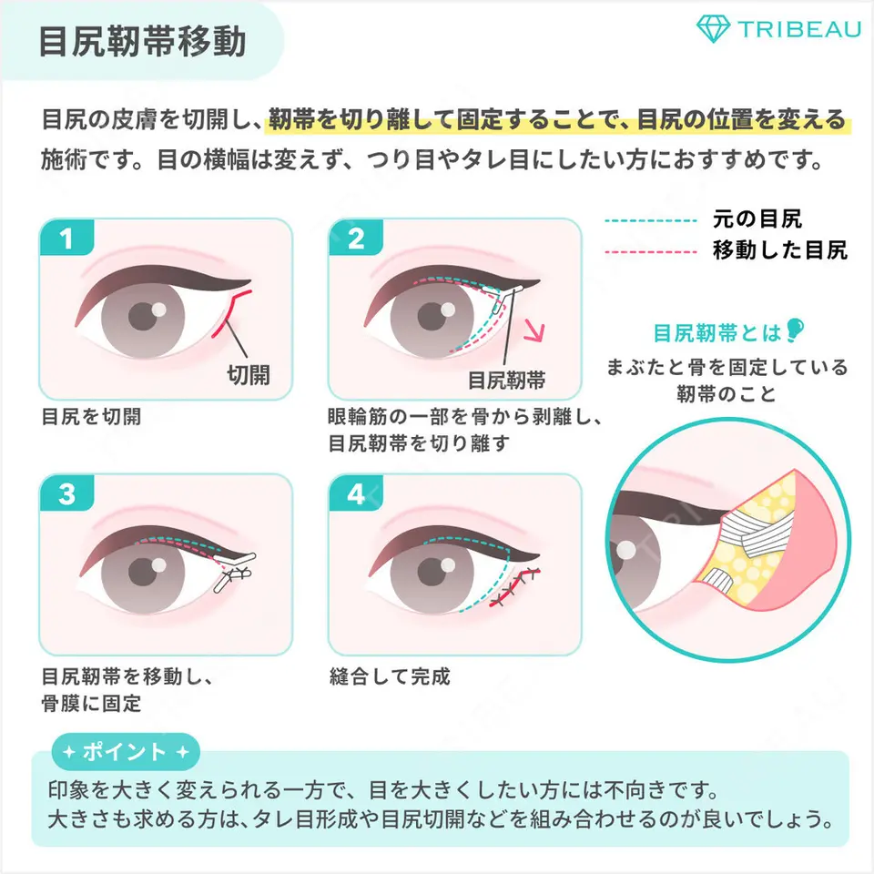 タレ目形成・グラマラスライン（切開）の美容外科・美容皮膚科クリニック一覧【489件】 | トリビュー[TRIBEAU]