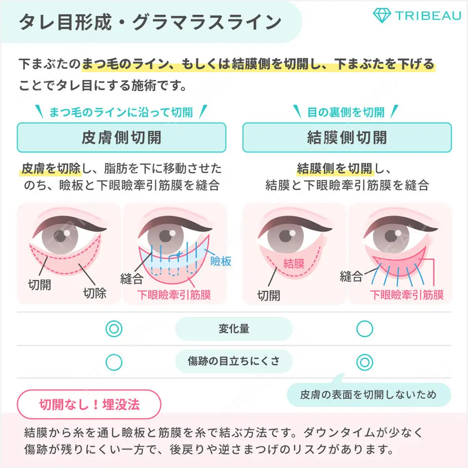 タレ目形成・グラマラスライン（切開）の美容外科・美容皮膚科クリニック一覧【489件】 | トリビュー[TRIBEAU]